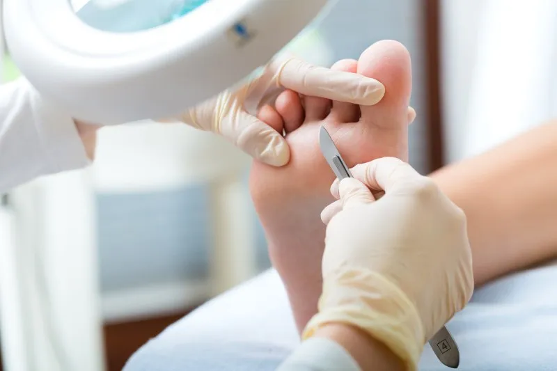 Spezielle Hautbehandlung in der Podologiepraxis