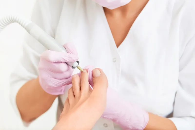 Spezielle Nagelbehandlung in der Podologiepraxis